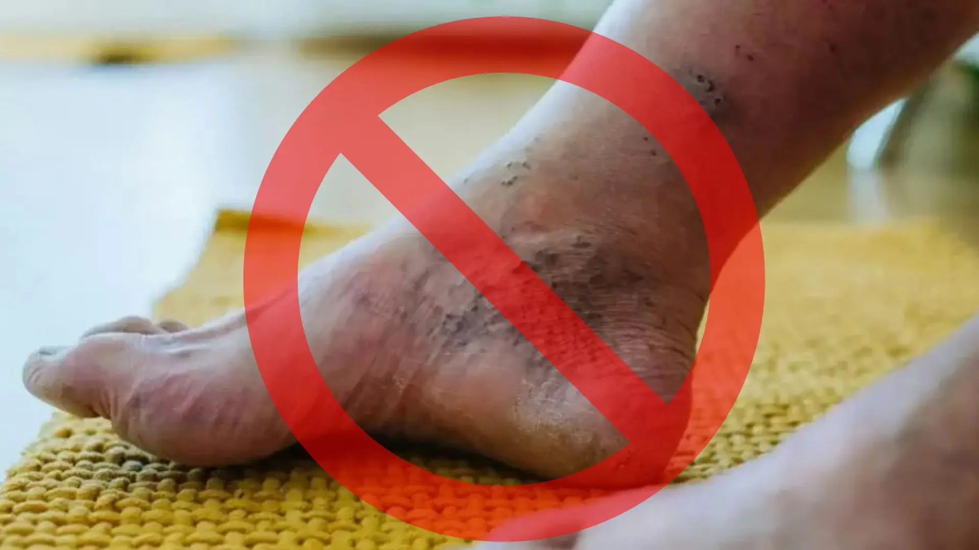 Before and After Transformation